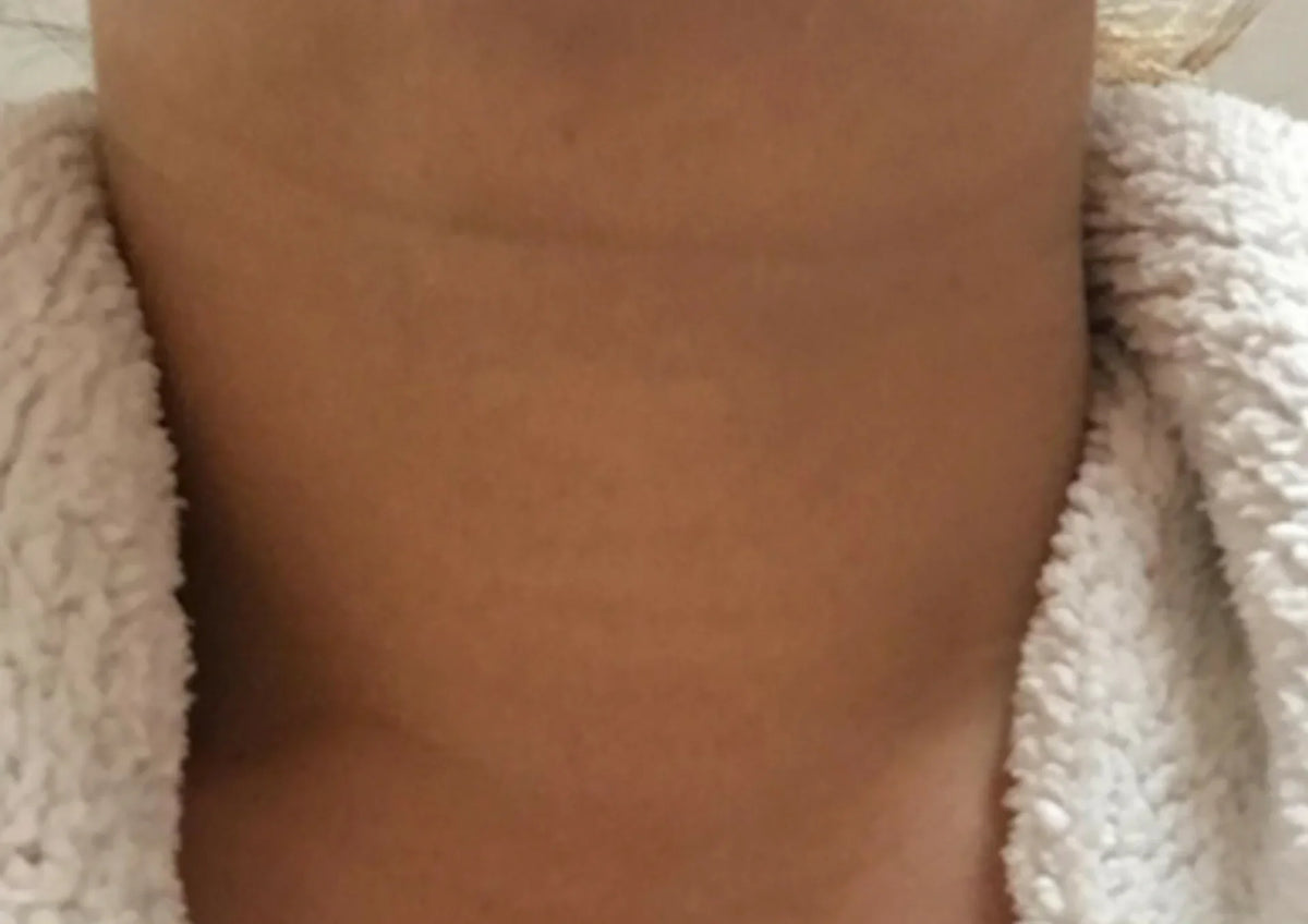 After transformation