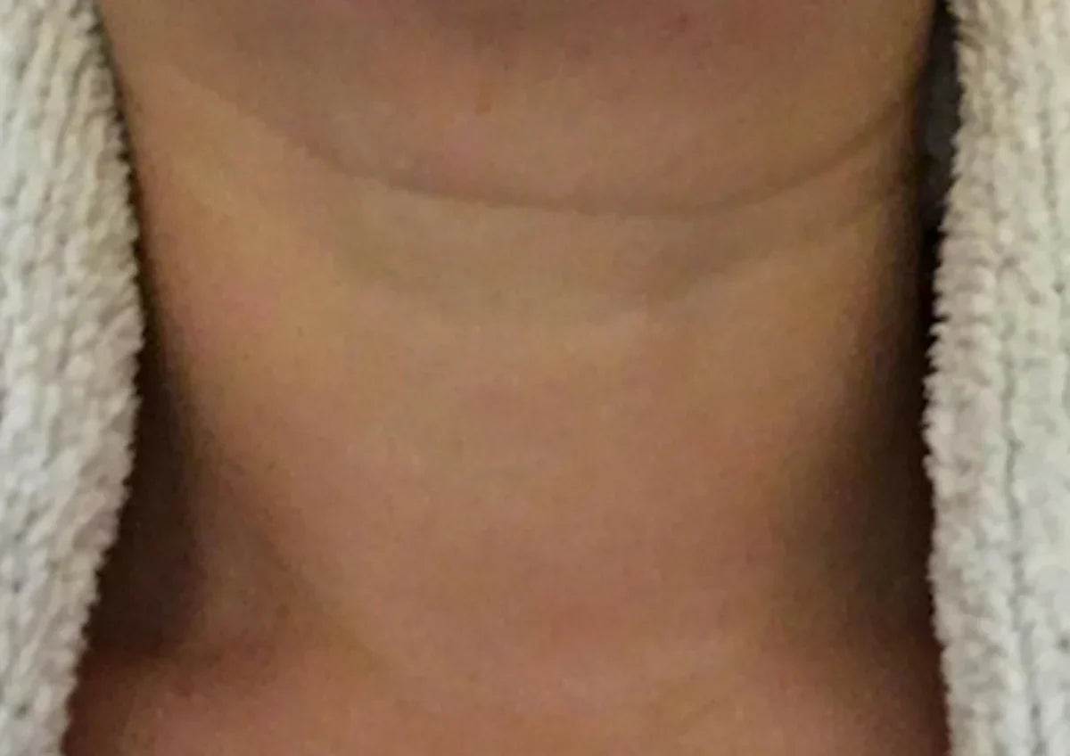 Before transformation