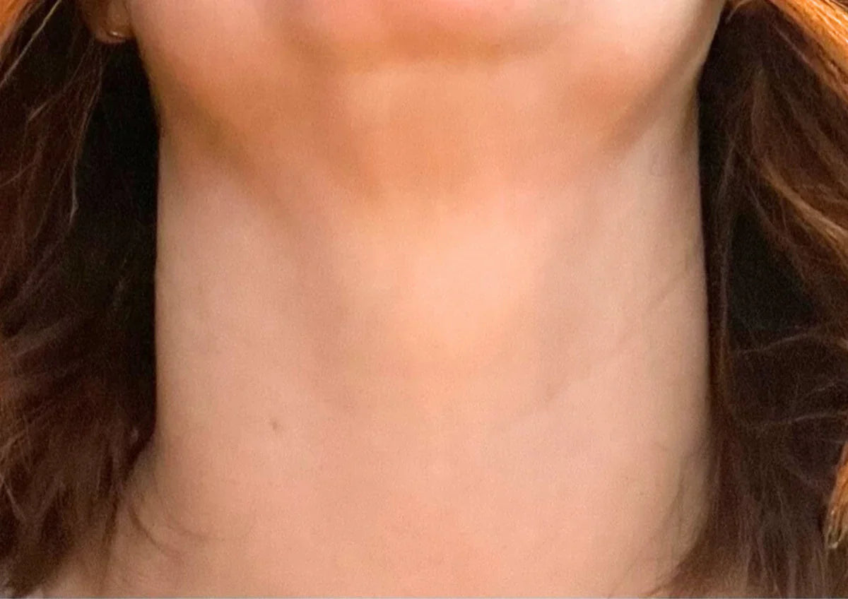 After transformation