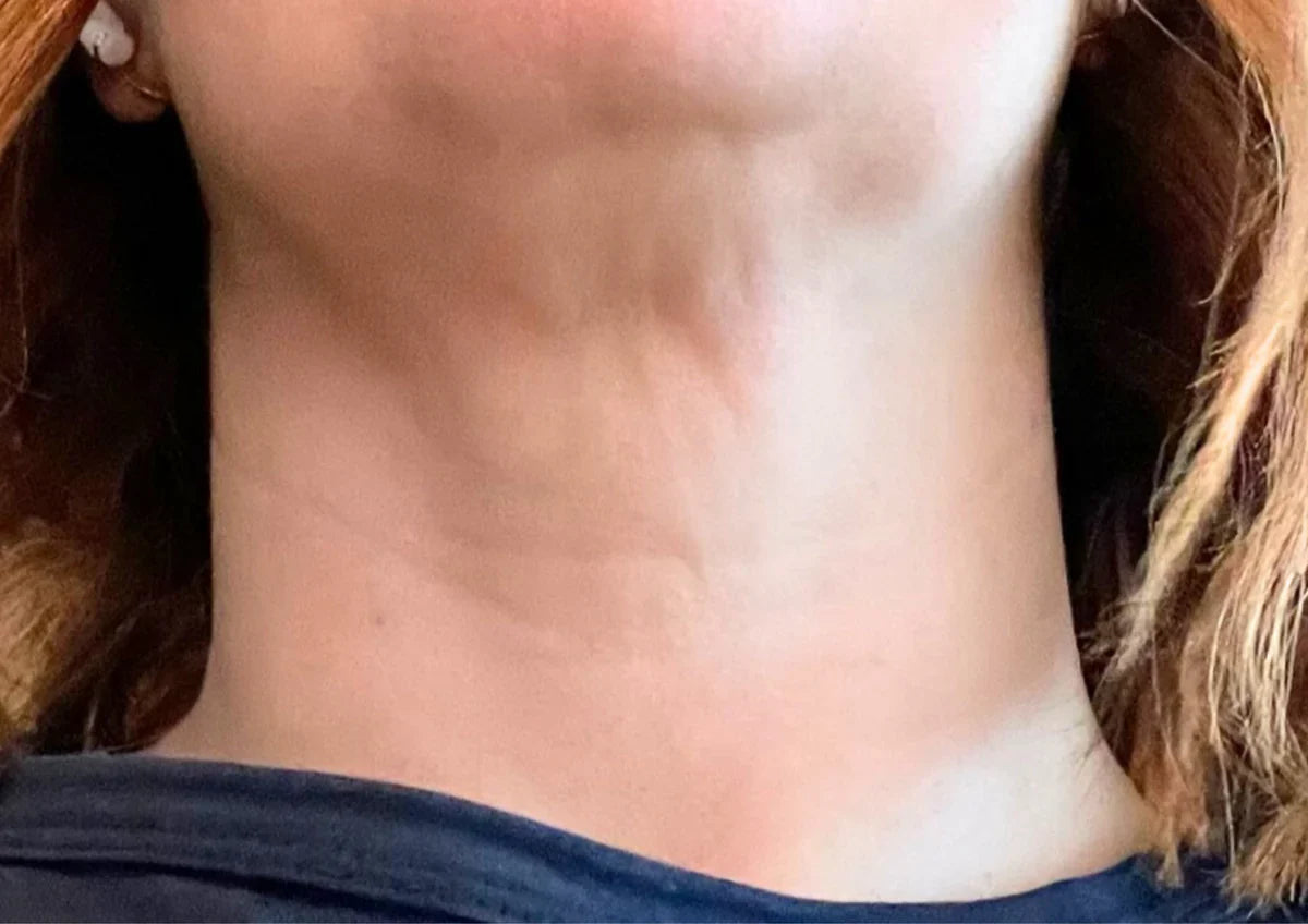 Before transformation