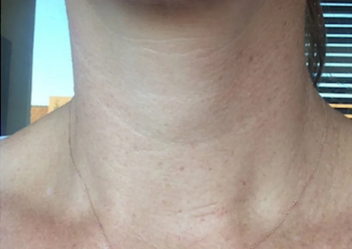 After transformation