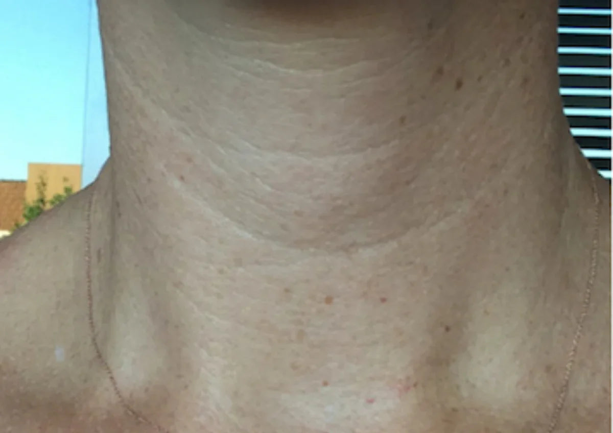 Before transformation